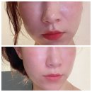 역삼 피부관리 TGV 뷰티에서 프랑스 딸고관리 후기