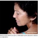 유착성 관절낭염 "오십견" 이미지