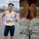 진태현 갑상선암 수술 이후에 인스타그램 소감 김우빈 응원 감사해 총정리 이미지