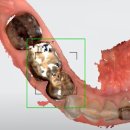 나온치과기공소 이미지