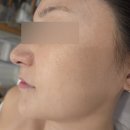 피부가 반짝반짝 | [동탄] 모공디톡스 받고 유리알피부 된 솔직후기🫧 '스킨바이비' 동탄피부관리 추천✨️