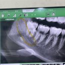 울산수치과의원 이미지