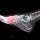 인제재활병원 이미지