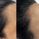 스칼프랩앤뷰티 속눈썹&눈썹&탈모 의정부점 이미지