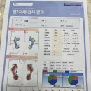 레푸스 분당정자점 무좀발톱 스케일링 비포애프터 추천 후기 w 김수민 푸스플레게