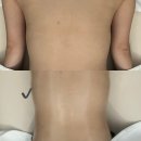 춘천 힌즈에스테틱에서 결혼 전 수기 상체관리 받고 온 후기(주차정보)
