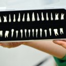 디지털센터치과기공소 이미지