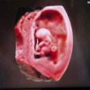 효성파마 | 나의 임신과 출산, 드디어 포리 탄생👶🏻