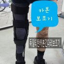 소망의수족보조기 네이버블로그