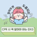 6-182 TS | CPR 상황에서 꼭 알아야 하는 심전도 리듬: 제세동이 필요한 리듬 vs 불필요한 리듬｜Cardioversion...
