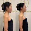 세븐일레븐 대구참사랑범어점 | 수성구피부관리 대구승모근 잘잡는 아로엘라 셀폰 스킨케어 4회차