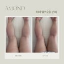 UR(파주시)-[소리천로]-상-9 | [파주 야당 피부관리] 퇴근 후 다녀온 아몬드! 하체 림프순환 케어 후기