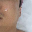 백서클린 | 모종동피부 관리 제대로 받았어요, 미인백서 에스테틱 솔직 후기