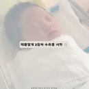삼성미즈병원 제왕절개 3일차 무통주사/페인부스터 제거 후기, 수유콜 시작