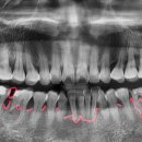 좌동로 93 이미지