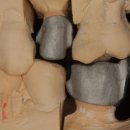 민치아치과기공소 이미지