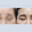 탑티어성형외과의원 이미지