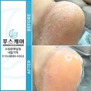 푸스케어 수원호매실점 이미지