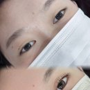 브로우온