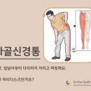 [W56] Vitality Chiropractic: 좌골신경통, 엉덩이부터 다리까지 저려요! 이미지