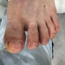 레푸스앤두두뷰티 | 의정부문제성발톱은 역시 레푸스 앤 두두뷰티!!