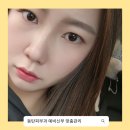 오리온피부관리실 | 동탄피부과 예신 맞춤 피부관리 스킨보톡스 후기