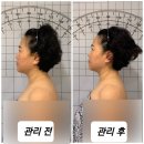 이네스뷰티테라피 | 이네스 뷰티 테라피에서 비대칭안면윤곽술 두골비 관리받은 후기