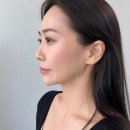 신세계안피부과 | 고속터미널역 피부과 티타늄 리프팅 후기 다운타임 없는 예비신부 관리 추천