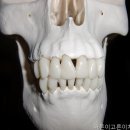 고른이치과의원 네이버블로그