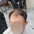 김호증모가발다온헤어