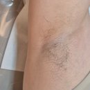 중앙동6 | 안산중앙동왁싱 겨드랑이 왁싱 제모 서하담 후기