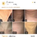 목주름 없애기! 종류에 따른 해결방법은?