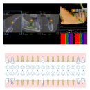 예스구구치과의원 | 자녀 결혼식을 앞두고 선택한 전악 임플란트 (2주 임시치아 후기)｜광주 북구 우산동 구구치과