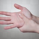 순천향정형외과의원 이미지