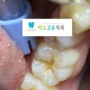 고운e치과 이미지