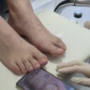 경산무좀발톱 치유네일&amp;오로지푸스, 경산문제성발톱 전문 관리 후기