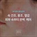 파티마피부관리실 | 대구 동구 피부관리 잘하는 곳, 뷰티로다에서 홍조 집중케어 후기
