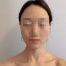 [발산역피부관리] 마곡역 신부 에스테틱, 여름아이뷰티끄 솔직 후기