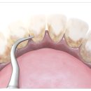 센텀뉴욕치과의원 이미지