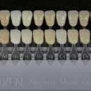 서울 덴탈 랩 이미지