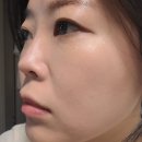 어라운더 스킨 이미지