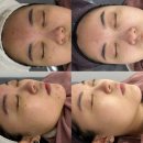 에이블메디 이미지