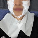 연세미앤필의원 | [시술] 신사 뷰티앤영 슈링크 내돈내산 찐후기!