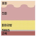 비올