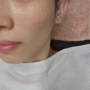 [위드왁싱앤뷰티 부천상동점] 부천피부관리샵에서 MTS관리 받은 후기