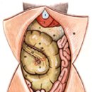 토끼가 아파요-1.위장관 질병 이미지