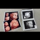 여의도튼튼척의원 | 임신 28주차｜입체초음파 후기·백일해 접종·다리 경련