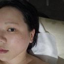 (주)세미부스터 | 상무지구 피부관리 디바스킨에서 스킨부스터 엑소좀 내돈내산후기