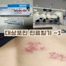 드랍탑시흥시화 | 대상포진 진료, 병원 옮긴 이야기(혐짤주의)