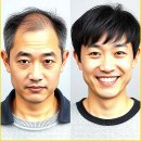 자연-이미지 | 자연스럽게 이미지 변신 성공 양주가발 후기